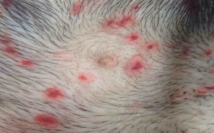 Dog Skin Ringworm Pictures - PetsWall